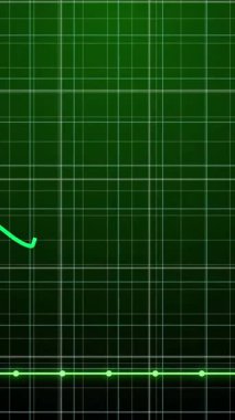 Animation of graphs over dark green background. Global finance, economy and technology concept digitally generated video.