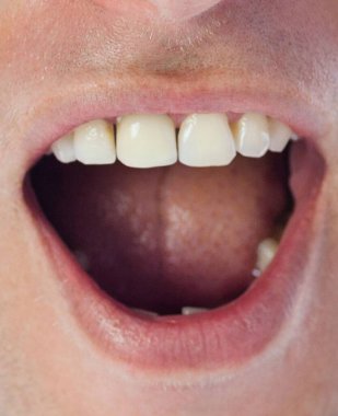 Düz tasarım, şeffaf arka planda dudakları, dişleri, dili ve sakalı olan açık erkek ağzını gösteriyor. Portre, yüz hatları, diş, sağlık, cilt bakımı, yakın plan, gerçekçilik