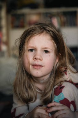 Suçiçeği olan sarışın küçük bir kız.