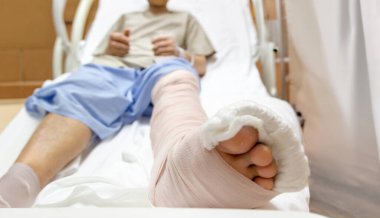 Hemşire Pediyatrist Doktor, kırık bacakları muayene ediyor. Kırık ayak bileği sakatlığı ve sigorta konseptinden sonra kısa bacaklı ortopedik alçı.