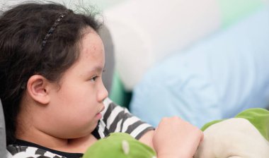 Sivilceli küçük kız yüzü Kameradan uzağa bak