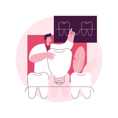 Diş protezleri soyut konsept vektör illüstrasyonunu yerleştirir. Takma diş implantı, diş beyazlatma, kalıcı diş değiştirme, kozmetik dişçiliği, ortodontik bakım prosedürü soyut metafor..