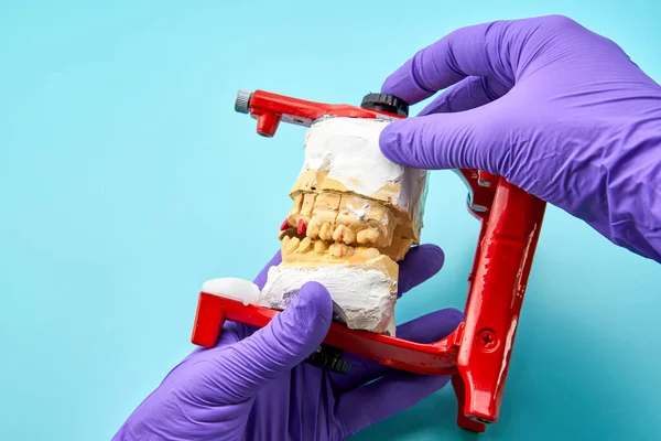 Prótesis Que Sostiene Una Prótesis Oficio Dental —  Fotos de Stock