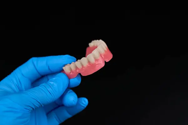 Görüntüde, takma diş tutan mavi eldivenli bir birey var. Önemli olan kişinin eli ve tuttukları takma diş.