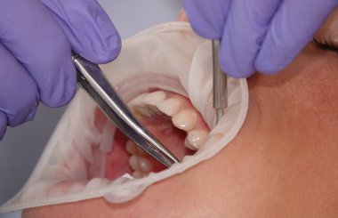 Kiev, Ukrayna 22 Ağustos 2020: Diş hekimi bir hastayla yakından ilgileniyor