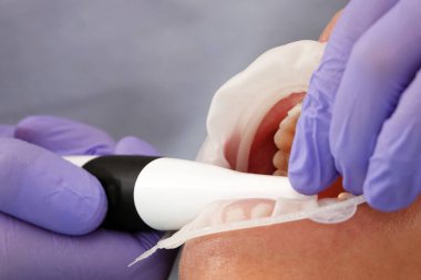 Kiev, Ukrayna 22 Ağustos 2020: Diş hekimi bir hastayla yakından ilgileniyor