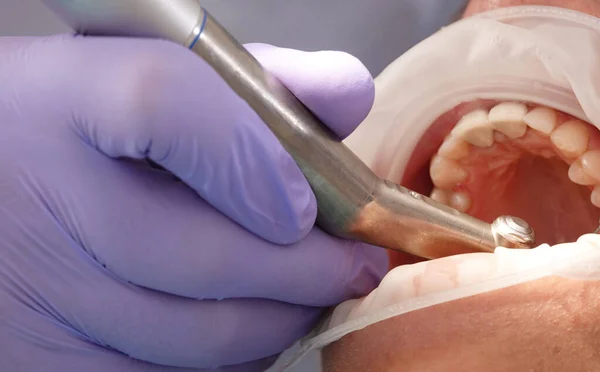 stock image Kiev, Ukraine August 22, 2020: Dentist doctor works with a patient close-up