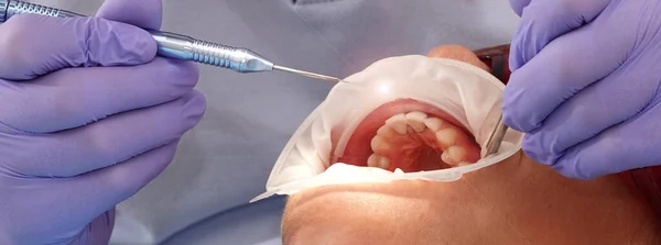 Stock image Kiev, Ukraine August 22, 2020: Dentist doctor works with a patient close-up