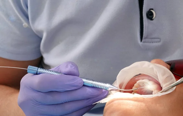 Kiev Ukraine Août 2020 Médecin Dentiste Travaille Avec Patient Gros — Photo