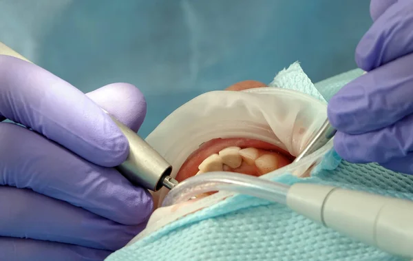 Stock image Kiev, Ukraine August 22, 2020: Dentist doctor works with a patient close-up