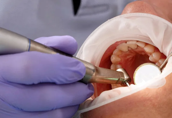 Stock image Kiev, Ukraine August 22, 2020: Dentist doctor works with a patient close-up