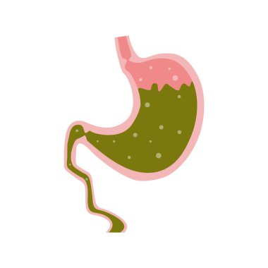 Meyve suyu ile mide, beyaz arka planda izole edilmiş karikatür düz stil yiyecek. Yemekten sonra normal sağlıklı mide anatomisi. Organın anatomi yapısı, yemek borusu ve duodenal sfinkter.