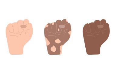 İnsan hakları kavramı. Yumruk dayanıyor. El çizimi vektör düz çizim. Beyaz, koyu ve vitiligo derili insan eli. Jest dili, çeşitlilik, protesto, kavga