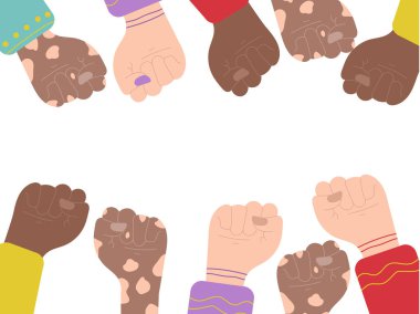 İnsan hakları için bir protesto sembolü olarak yükselen yumruklar. Çeşitlilik kavramı, ırk çatışmaları, vitiligo hastalıkları. Düz bir şekilde elle çizilmiş vektör çizimi. İnsan elleri havada, kışkırtma, seçimler