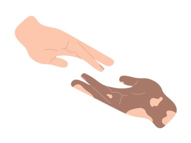İki el birbirine uzanıyor. Yardım kavramı, çeşitlilik, arkadaşlık işareti. Dünya Vitiligo Günü. Yardım elini uzat. Tedavi sembolü. Düz biçimli elle çizilmiş vektör illüstrasyonu