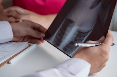 Röntgen filmi kullanan kadın doktor, hasta raporlarını analiz etti, hastayla konuştu ve hastaların ellerine dokundu..