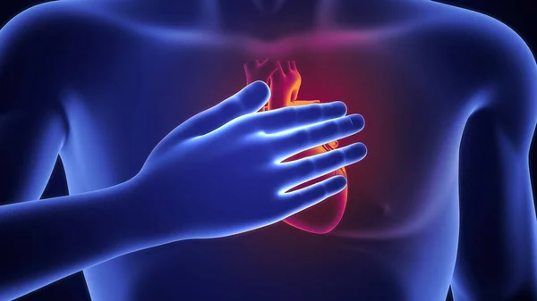 3d illustration of heart attack in blue body