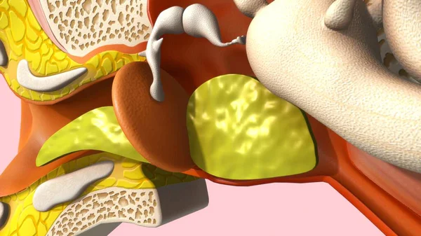 人間の耳の説明膿3Dレンダリングイラスト — ストック写真