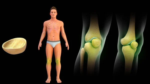 Illustration Patella Bone Knee Joint Rendered — Stock Photo, Image