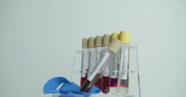 Slow motion, rotating sample splitter for analytical measurement in pharmacy laboratory, medical exposure