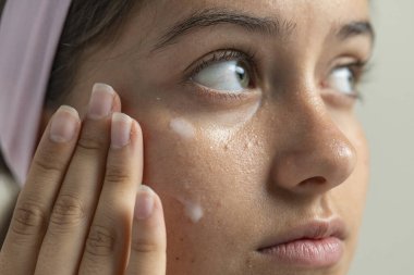 Dermatolojik makro fotoğraf, bir kadının gözünün altındaki hassas cilde milia 'yı tedavi etmek için krem sürdüğünü gösteriyor.