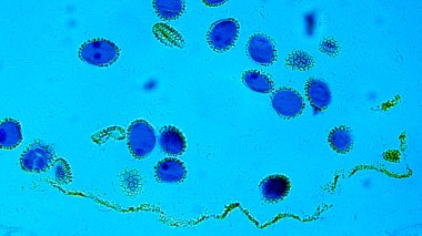 Optik Mikroskop altında Lillium Anther