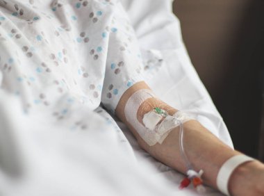 Damarında saydam tıbbi yapıştırıcı bantla bantlanmış beyaz çarşaflı bir yatakta yatan, beyaz çarşaflı, yakın çekim manzaralı beyaz bir hastanın eli. Hastalıkların tedavisi, uyuşturucu bağımlılığı kavramı.