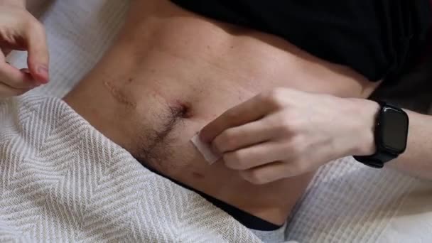 ある若い白人未確認の男性は 無菌ウェットワイプで胃を拭き取り 注射のために準備し ベッドに横たわり 上からのクローズアップビュー ステップ2 — ストック動画