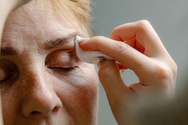 Genç, beyaz, tanınmayan bir kozmetik uzmanı yaşlı bir kadının sol kaşındaki boyayı pamuk pedle temizleyici kullanarak dikkatlice çıkarıyor.