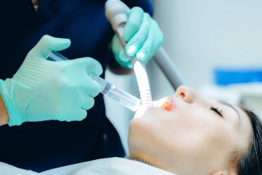 Tanımlanamayan genç bir beyaz dişçinin elleri. Yeşil eldivenli. Anesteziyi bir kızın ağzına şırıngayla enjekte ediyor. Diş etlerinin tedavisi için kavram ve