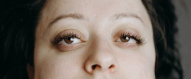 İki açık ve şişkin göz, kahverengi göz bebekleri ve kameraya şaşı bakan güzel ve güzel beyaz bir kadının geniş kirpikleri. Kirpik uzatma konsepti, güzellik endüstrisi, tıp.