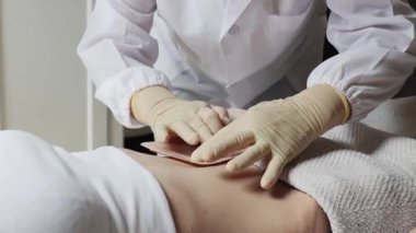 Steril eldivenli, tanınmayan beyaz yaşlı bir kadın doktor gündüz vakti klinik koğuşunda ayakta duran genç bir hastanın karın bölgesine dikkatlice kolostomi torbası yapıştırıyor. Karın hastalıkları konsepti, hemşire hizmetleri.