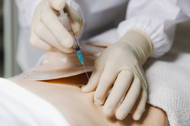 Tanınamayan beyaz bir doktorun portresi steril eldiven giymiş, karnına şırınga enjekte ediyor, kolostomi torbasıyla bir kliniğin koğuşunda yatan bir kızın yatağında yatıyor, çok yakından bakıyor. Abdominal kavramı
