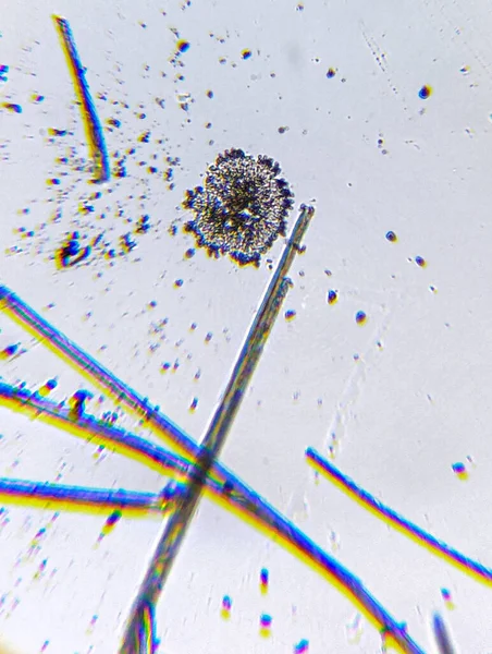 Aspergillus niger, Hindistan 'ın mikroskop görüntüsü.