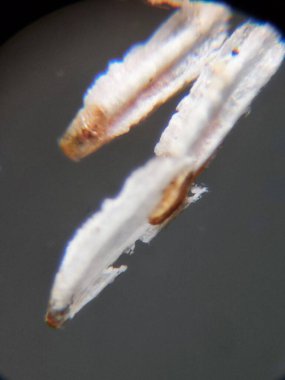 Unaspis euonymi ya da öonymus ölçeği 