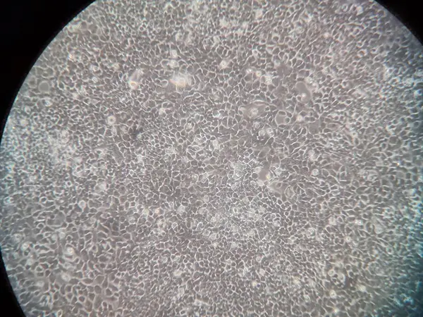 Mikroskop altında ağız kanseri hücreleri