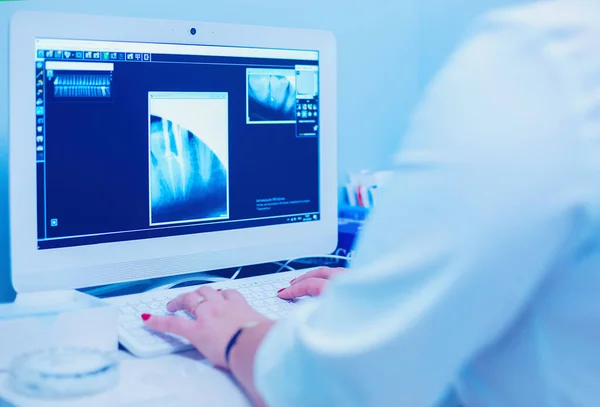 Female Medical Doctor Looking Rays Using Laptop Hospital — Stock Photo, Image