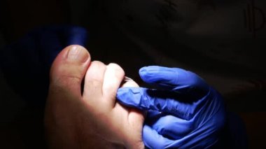 Karanlıkta ayak hastalıkları tedavisine yakın çekim. Seçici odak