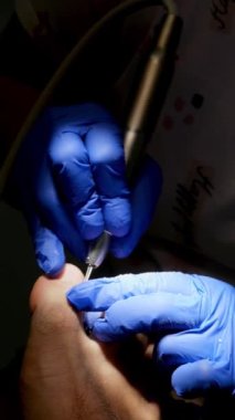 Karanlıkta ayak hastalıkları tedavisine yakın çekim. Seçici odak