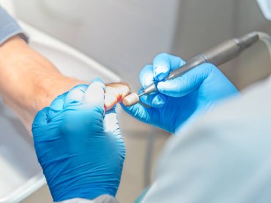 Ayak hastalıkları tedavisine yakın çekim. Seçici odak