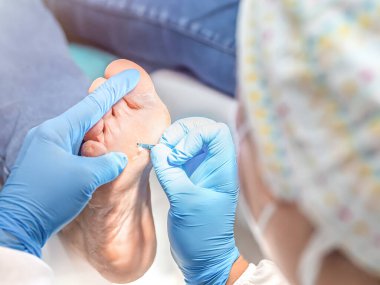 Ayak hastalıkları kliniğinde ayak masajı yapan bir kadın ayak hastalıkları uzmanı. Seçici odak