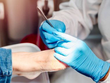 Ayak hastalıkları tedavisine yakın çekim. Seçici odak