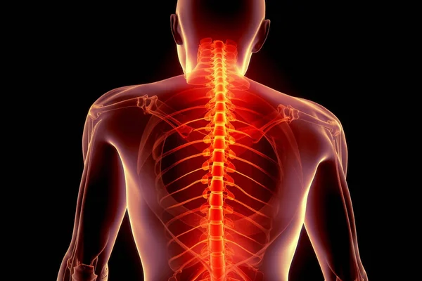Pain in the spine, pain in the back, lumbar spine. x-ray view. 3d illustration