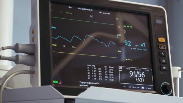 Монітор Серцебиття Показує Пульс Пацієнта Хірургічному Столі Монітор Частоти Серцевих — стокове відео