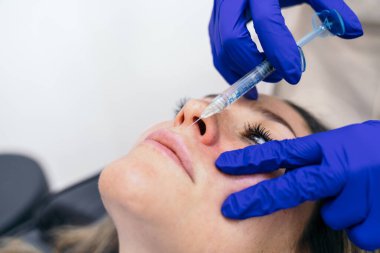 Uzman estetisyen, burun kıvrımlarını yumuşatmak için bir hiyalüronik asit doldurucusu yönetir..