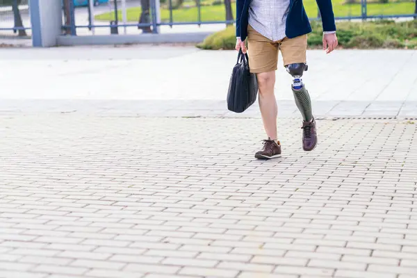 An unrecognizable confident man with a prosthetic leg walks on a paved path, carrying a black bag, showcasing determination.