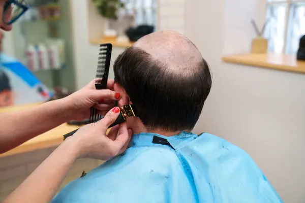 クリニックでのヘアピースフィッティングのための頭皮の準備 — ストック写真