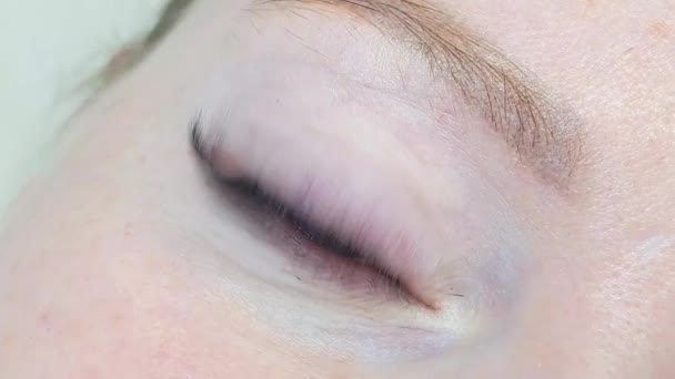 Nahaufnahme Des Blauen Auges Mit Wimpernverlängerungen Schönheitssalon Behandlung — Stockvideo