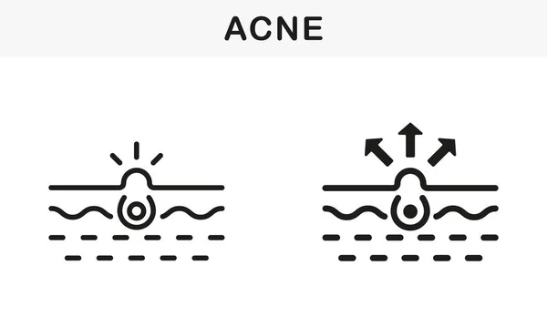 Skin Acne Blackhead Comedo Line Silhouette Black Icon Set Pittogramma — Vettoriale Stock