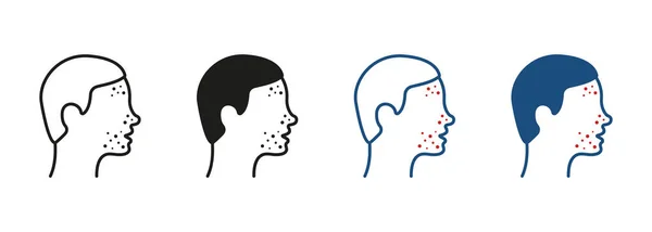 Man Met Blackhead Acne Rash Pictogram Dermatologisch Probleem Allergie Ontstoken — Stockvector